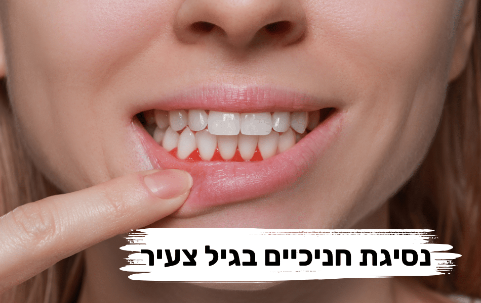 מדוע מתרחשת נסיגת חניכיים בגיל צעיר